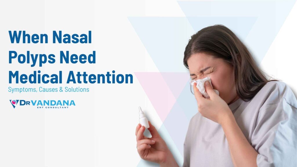 nasal polyps
