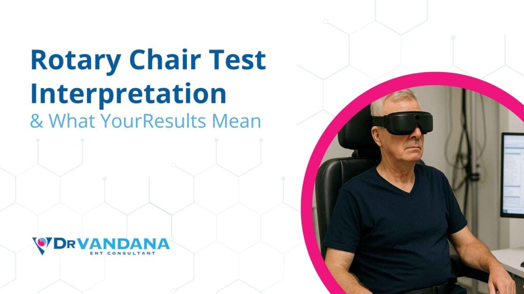Rotary Chair Test Interperation